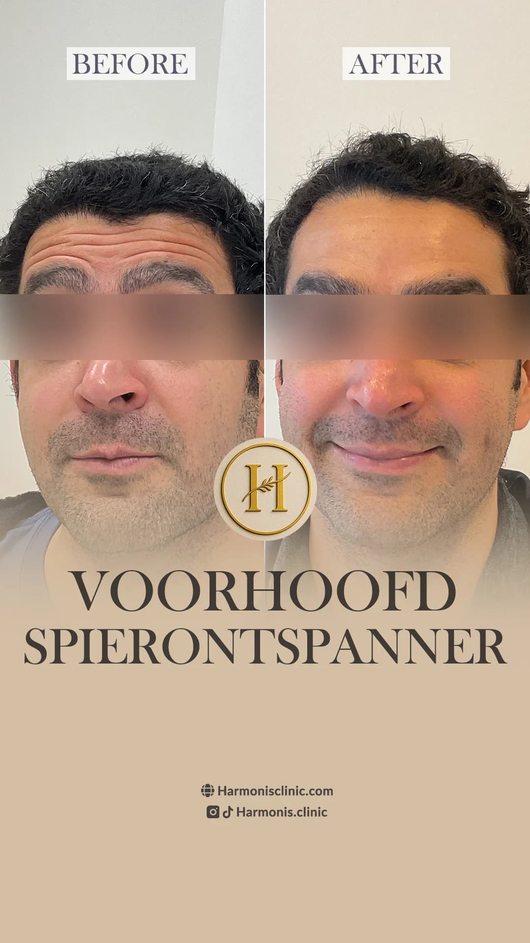Before and after treatment result