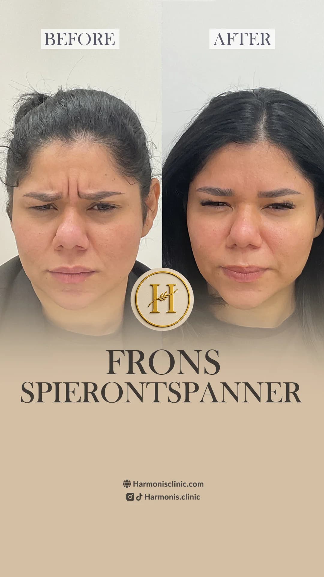 Before and after treatment result