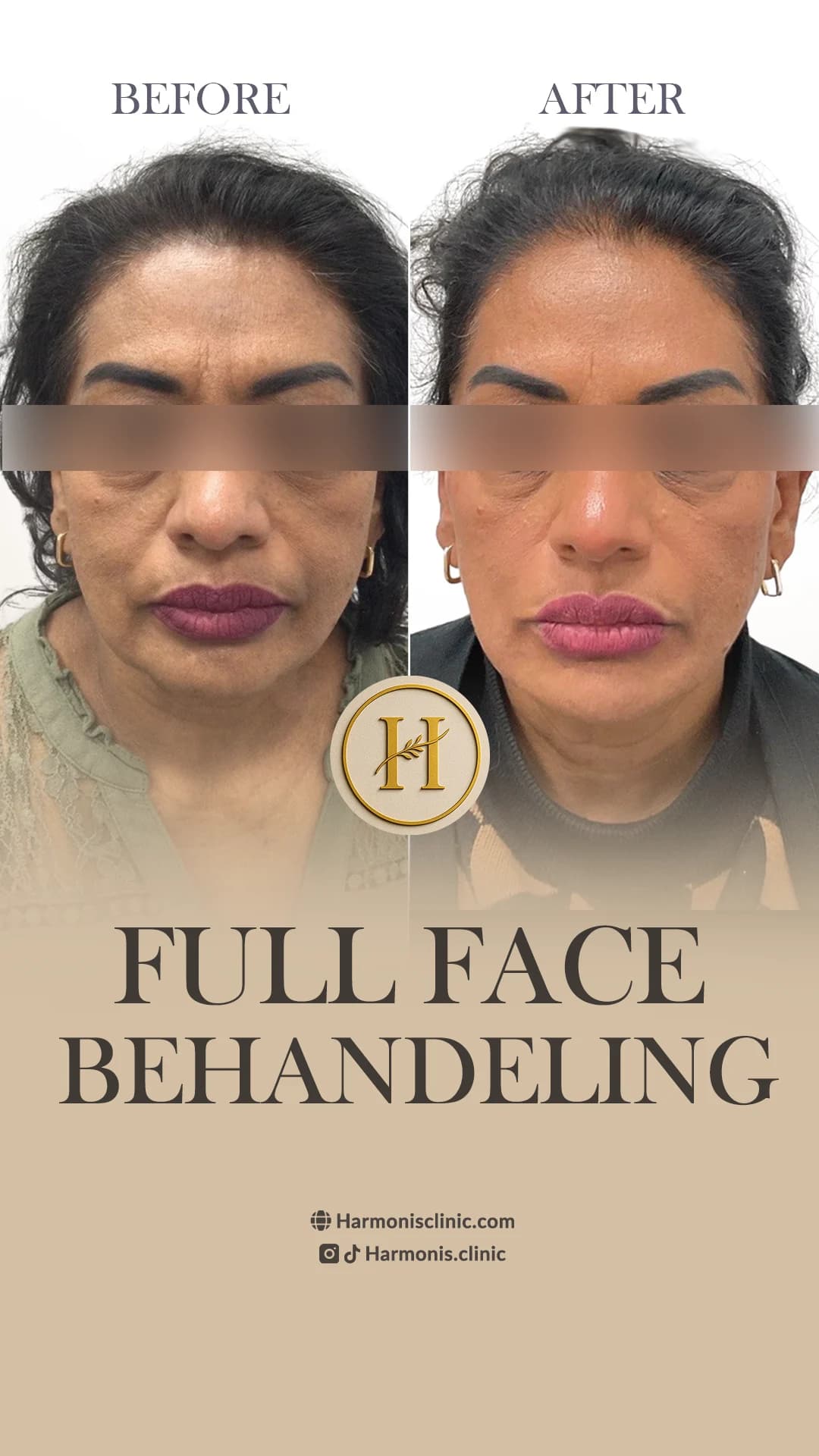 Before and after treatment result