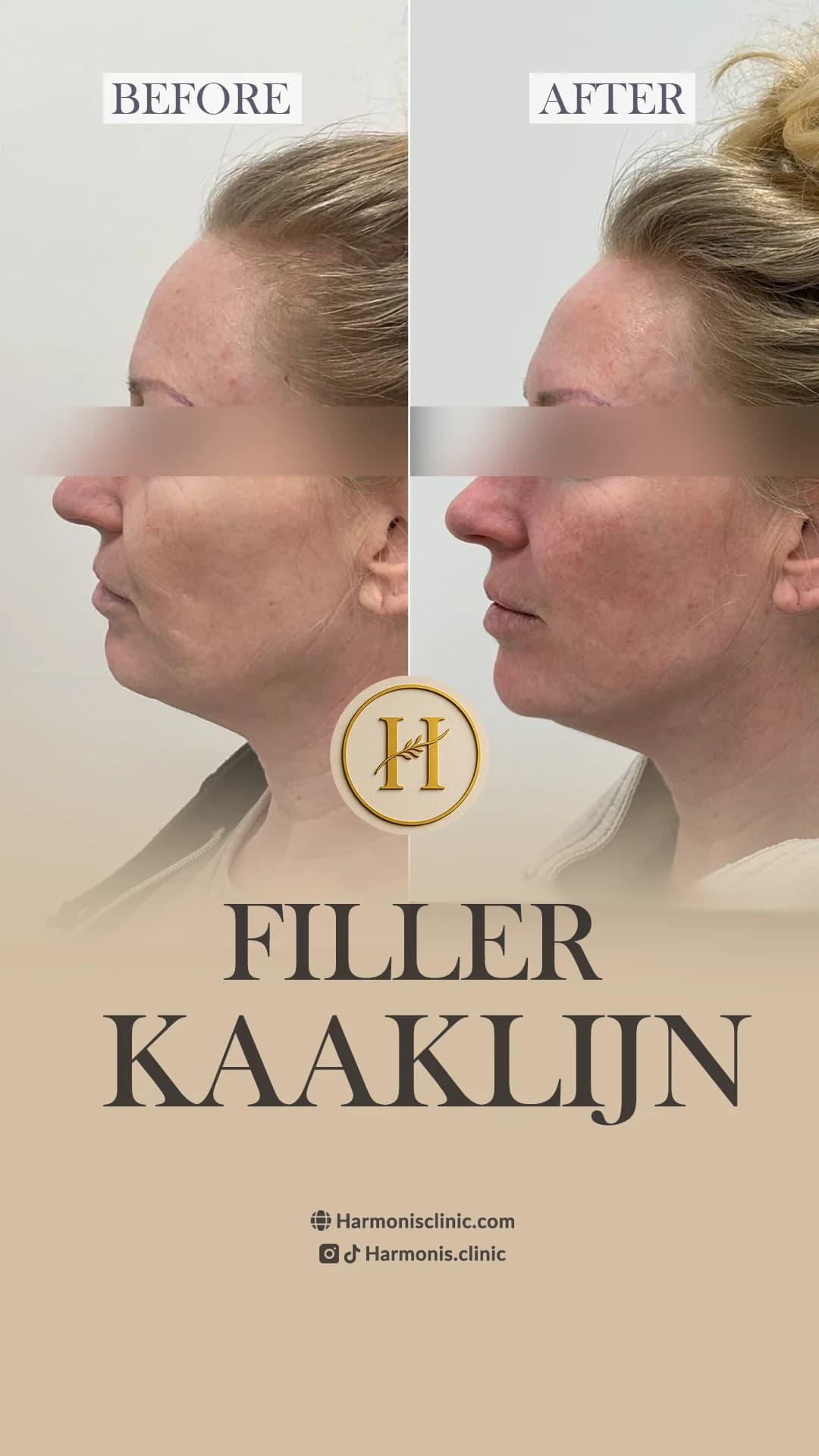 Before and after treatment result