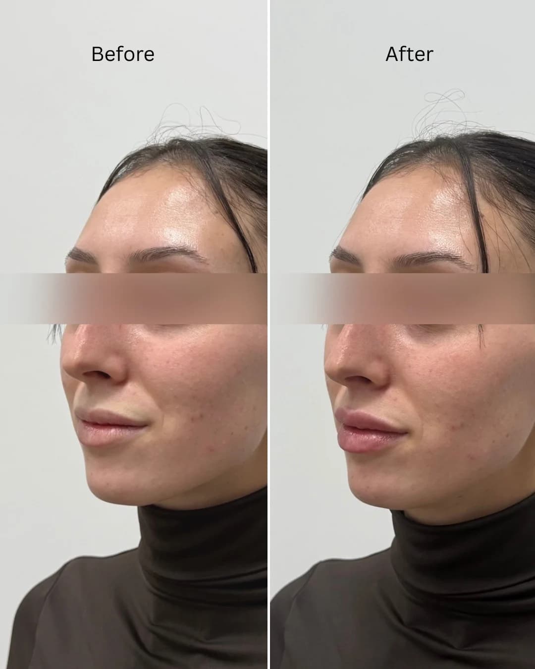 Before and after treatment result