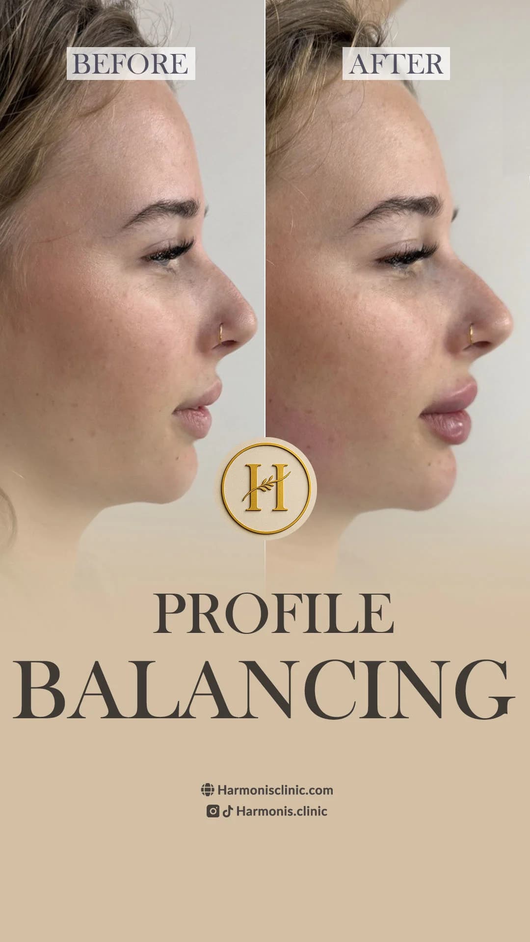 Before and after treatment result